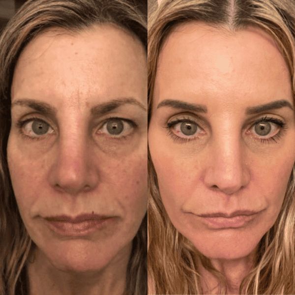 Bakuchiol Age Delay Serum user survey results showing brighter, more radiant skin